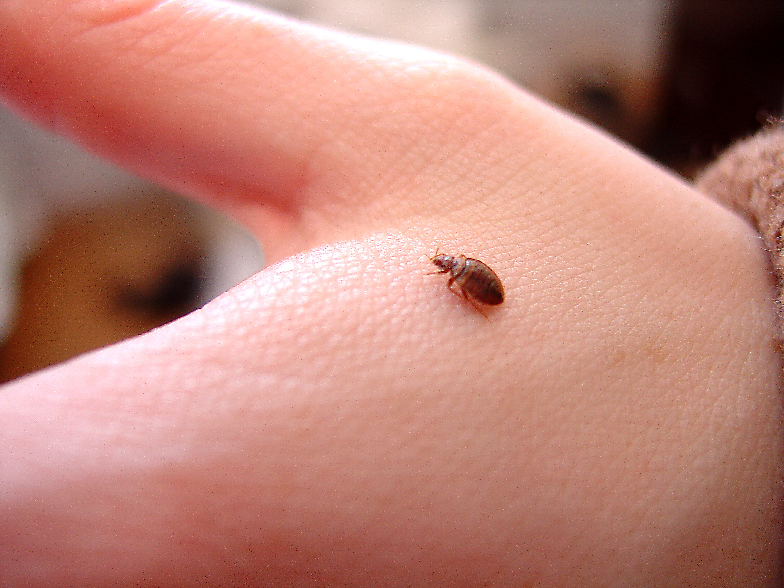 Bed Bug on Hand