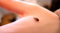 bed bug feeding
