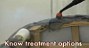 bed bug treatment