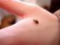 image of Bed Bug on hand