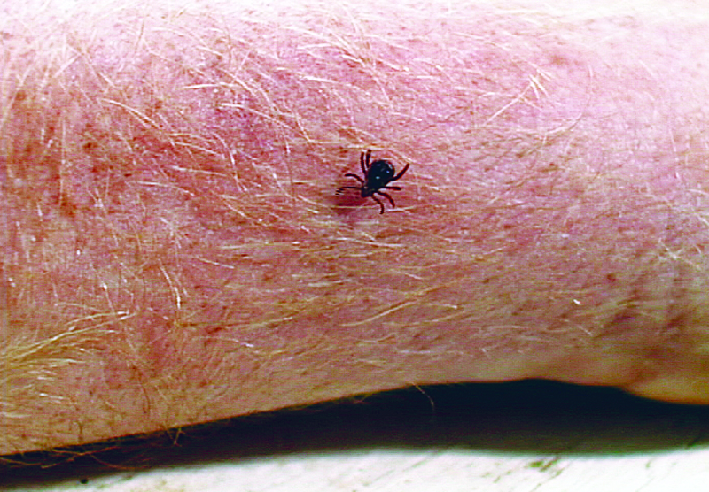 Tick And Tick Bite Identification Tick Control And Prevention Orkin